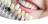 Por que as lentes de contato dental agregam valor ao seu sorriso?