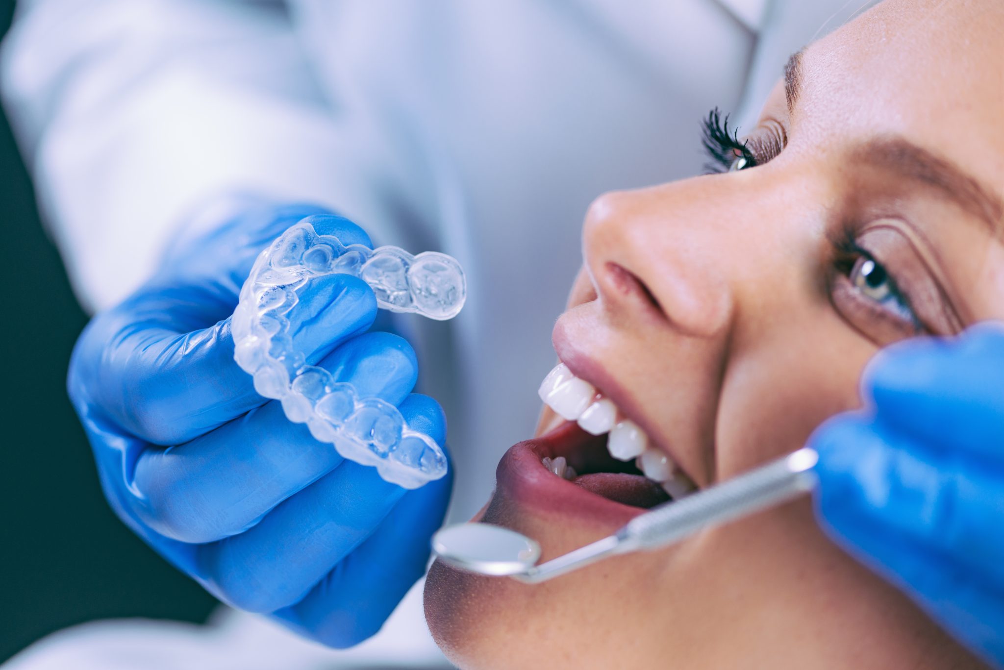 Por que as lentes de contato dental agregam valor ao seu sorriso? - image clareamento-dental-procedimento-1-scaled on https://molinosodontologia.com.br